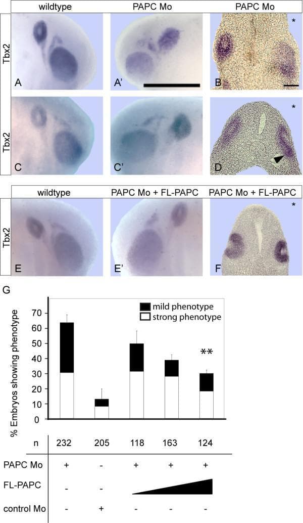 This composite figure illustrates the role of Paraxial Protocadherin (PAPC) in inner ear development using a Xenopus embryo model. (A-F) Micrographs show in situ hybridization (ISH) for Tbx2, an early marker of otic placode and vesicle formation. In wildtype embryos (A, C, E), the otocyst exhibits a rounded morphology with a distinct inner cavity (unstained center). In PAPC antisense morpholino (PAPC Mo) injected embryos, severe phenotypes (A', B) show complete loss of the otocyst cavity and flattened morphology, while mild phenotypes (C', D) show irregular epithelial infolding (arrowhead) and diffuse Tbx2 signal. Transversal sections (B, D) confirm the structural disruption of the otic epithelium on the injected side (asterisks). (E-F) Rescue experiments demonstrate that coinjection of full-length PAPC (FL-PAPC) RNA restores normal otocyst morphology and cavity formation. (G) A stacked bar chart provides statistical quantification of the phenotypes, showing a dose-dependent reduction in strong and mild phenotypes upon increasing FL-PAPC RNA rescue compared to the PAPC Mo group. This research identifies PAPC as a critical regulator of apical-basal cell alignment and morphogenetic movements during otocyst development.