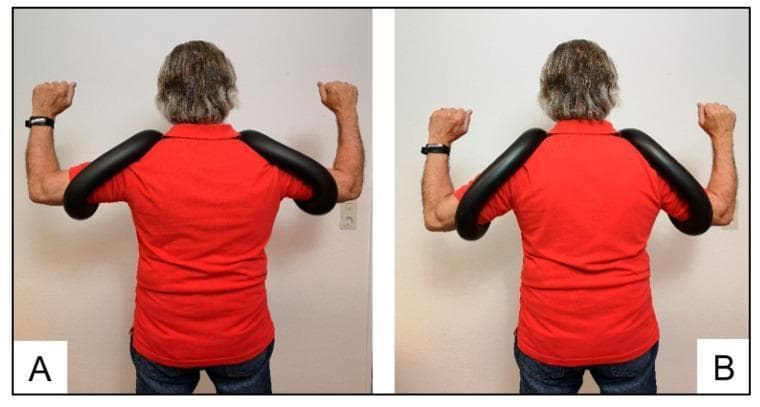 Clinical photograph (posterior view) of a patient demonstrating the use of two variations of a manual shoulder-training device, Schulterhilfe®, designed for rotator cuff rehabilitation. The images compare arm positions during therapeutic exercise. Panel A (Standard) shows the arms supported in 90-degree glenohumeral abduction with the horseshoe-shaped, rubber-covered frame positioned behind the neck. Panel B (Akut) displays the arms in a lower 45-degree abduction position, with the device frame positioned anterior to the neck, suitable for patients with limited joint flexibility or acute subacromial pain. The device is a thick, synthetic, padded tube that stabilizes the upper arms to reduce deltoid muscle activation and increase subacromial space during external rotation exercises. This setup is intended to isolate the infraspinatus and teres minor muscles while minimizing intraarticular pressure. The patient is shown in a standing position, wearing a red shirt, with the forearms flexed and fists clenched as if performing external rotation movements.