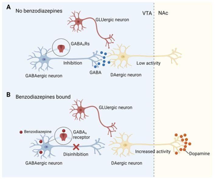 This pathophysiology diagram illustrates the neurobiological mechanism of benzodiazepine addiction through disinhibition of dopaminergic neurons in the mesolimbic reward system. The illustration is divided into two comparative panels. Panel A (No benzodiazepines) shows a baseline state in the Ventral Tegmental Area (VTA), where a blue GABAergic interneuron releases GABA molecules to inhibit a yellow dopaminergic (DAergic) neuron via GABAA receptors, resulting in 'Low activity' and minimal dopamine release in the Nucleus Accumbens (NAc). A GLUergic neuron is also shown nearby. Panel B (Benzodiazepines bound) depicts the introduction of red benzodiazepine molecules, which bind to GABAA receptors on the GABAergic interneuron. This binding induces 'Disinhibition' of the downstream DAergic neuron (indicated by an 'X' over the inhibitory synapse). Consequently, the DAergic neuron exhibits 'Increased activity,' leading to a significant rise in dopamine release (red molecules) within the NAc. The diagram highlights how benzodiazepines modulate neuronal signaling to trigger the brain's reward circuitry.