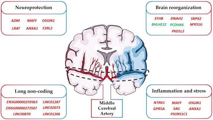 This infographic presents a pathophysiology diagram of an ischemic stroke and its associated molecular changes. At the center is a stylized horizontal cross-section of a human brain. The right hemisphere is shaded light blue to indicate an affected vascular territory, with an arrow highlighting the 'Middle Cerebral Artery' (MCA). Red vascular structures represent perfusion, while the blue-tinted vessels on the right correspond to the stroke zone. Surrounding the brain are four labeled boxes classifying Differentially Expressed Genes (DEGs) into clinical categories: 'Neuroprotection' (e.g., ADM, ANXA1), 'Brain reorganization' (e.g., EFHB, BHLHE22), 'Long non-coding' (e.g., LINC01287), and 'Inflammation and stress' (e.g., NTRK1, PSORS1C1). The text colors denote expression levels: red gene names signify upregulation (increased expression) and green gene names signify downregulation (decreased expression) following a stroke event. This visual aid is intended for medical education on the genomic response to cerebrovascular accidents and neuroinflammation.