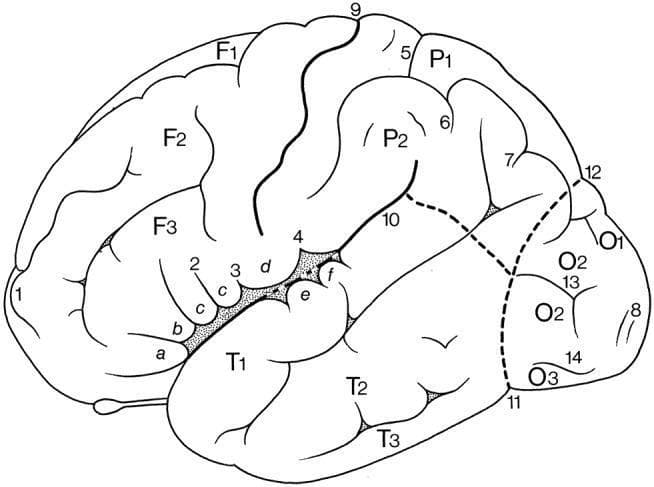 This anatomical diagram illustrates the superolateral surface of the human cerebral hemisphere, highlighting the primary gyri and sulci using a alphanumeric labeling system. The frontal lobe is categorized by gyri F1 (superior), F2 (middle), and F3 (inferior), with F3 further subdivided into orbital (a), triangular (b), and opercular (c) parts. The parietal lobe displays the superior (P1) and inferior (P2) parietal lobules. The temporal lobe contains the superior (T1), middle (T2), and inferior (T3) temporal gyri, while the occipital lobe shows the superior (O1), middle (O2), and inferior (O3) occipital gyri. Major landmark sulci are numbered, including the central sulcus (9), lateral sulcus (10), and parietooccipital sulcus (12). Secondary features such as the subcentral gyrus (d), transverse temporal gyri of Heschl (e, f), and the diagonal sulcus of Eberstaller (2) are also indicated. This schematic provides a foundational reference for neuroanatomical classification and functional localization within the human cerebral cortex.