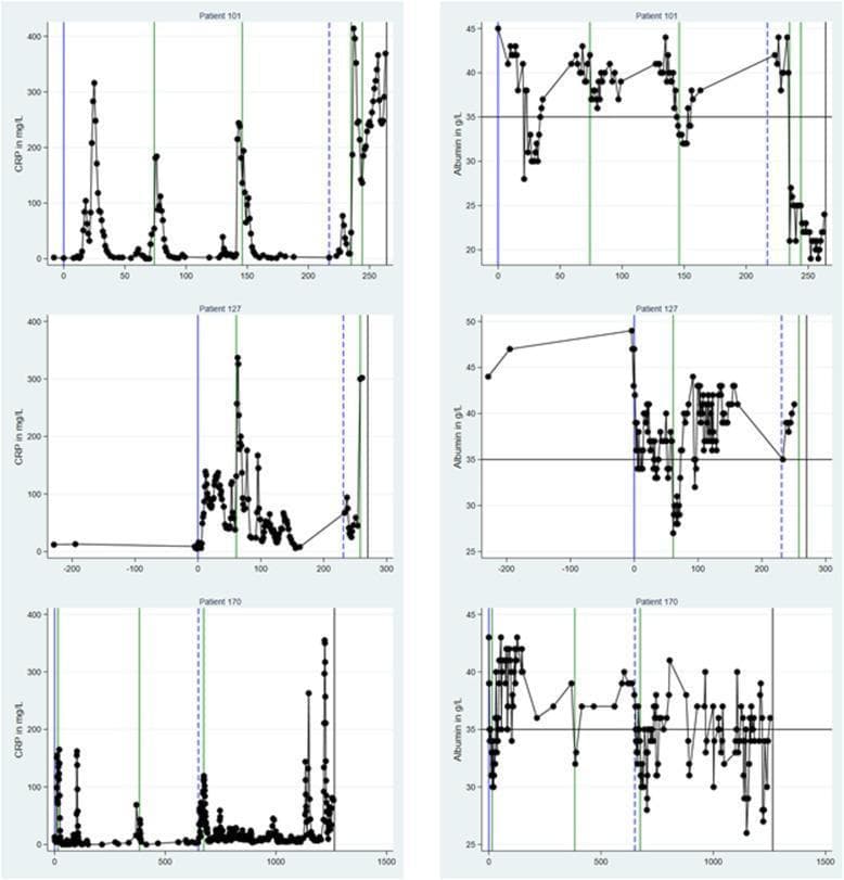 This Comparison Chart illustrates the longitudinal trajectories of C-reactive protein (CRP) and plasma albumin (PA) levels in three individual patients (101, 127, 170) following a diagnosis of acute myeloid leukemia (AML). The figure consists of six subplots arranged in a 3x2 grid. The left column measures CRP levels (mg/L), representing a positive acute-phase reactant, while the right column measures plasma albumin (g/L), representing a negative acute-phase reactant. The x-axis tracks time (days) relative to AML diagnosis (Day 0, solid blue line).
Key clinical milestones are marked with vertical indicators: solid blue lines for diagnosis, solid green lines for bacteraemic episodes, dashed blue lines for AML relapse, and solid black lines for death. A horizontal reference line at 35 g/L in the albumin plots indicates the threshold for hypoalbuminemia. The graphs demonstrate a typical inverse relationship during inflammatory events, such as infections or disease progression, where sharp spikes in CRP correspond to significant drops in albumin. This data is relevant for hematology and oncology, highlighting the use of these biomarkers in monitoring disease activity, infection risk, and nutritional/prognostic status in leukemia patients.