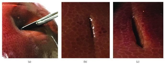 This sequence of clinical photographs illustrates the physical dynamics of surgical incision on parenchymal soft tissue, specifically a liver specimen. The image is divided into three stages: (a) initial penetration where a metal scalpel blade enters the tissue, showing visible elastic deformation and focal compression around the point of entry; (b) a small, linear incision demonstrating neat, closely apposed edges with minimal tissue gaping and a moist, glistening surface; and (c) a larger, deeper incision showing significant separation of the wound edges. This final stage reveals the internal parenchymal structure and a darker void representing the depth of the cut. The series demonstrates the biomechanical transition from energy accumulation during initial contact to the release of intrinsic energy during fracture, resulting in the formation of smooth, distinct surgical planes. This content is relevant for surgical training, demonstrating real-world tissue response to mechanical cutting compared to virtual simulations.