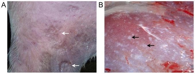 Clinical and gross pathology photographs demonstrating the tissue-level manifestations of Schistosoma japonicum infection.
Panel A shows a clinical photograph of the skin on the inner thigh of a bovine model. The image exhibits visible signs of inflammation, characterized by localized erythema and edema. White arrows specifically indicate raised, papular inflammatory reactions at the site of cercarial penetration five days post-infection.
Panel B displays a gross pathological view of a liver surface during necropsy. The liver parenchyma shows evidence of chronic schistosome infection. Black arrows highlight numerous, discrete white nodules (granulomas) distributed across the organ surface. These nodules are indicative of egg-induced pathology, where the host immune response forms fibrotic granulomatous lesions around trapped parasite eggs.
This comparison illustrates the transition from the acute cutaneous phase of schistosomiasis (swimmer's itch/cercarial dermatitis) to the chronic visceral phase involving hepatic egg pathology.