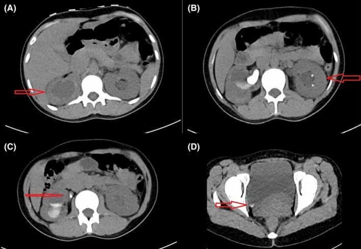 Hugging Face pmc clinical VQA raw
