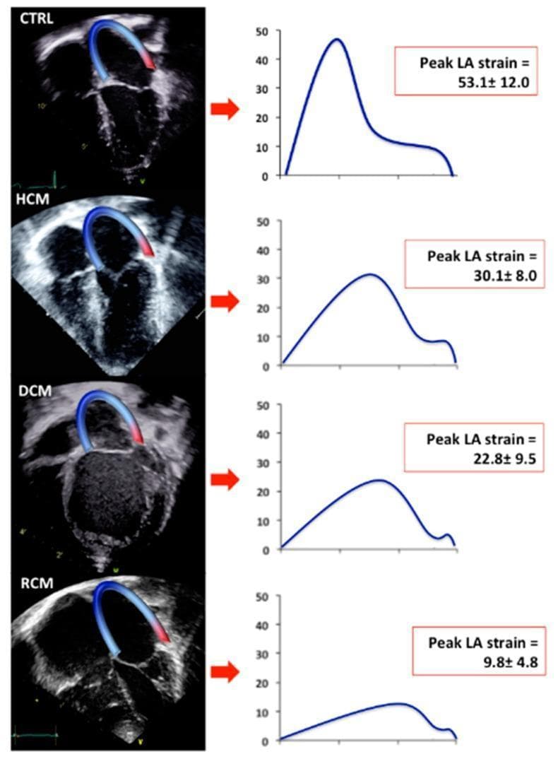 Hugging Face pmc clinical VQA raw