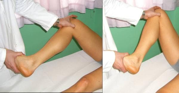 Two clinical photographs demonstrate the performance of the McMurray test, a physical examination maneuver used to evaluate for meniscal injuries of the knee. The patient is in a supine position on an examination table. In the left panel, the examiner flexes the patient's knee to approximately 90 degrees while grasping the patient's heel with one hand to control tibial rotation. The other hand is placed over the knee joint, with fingers palpating the joint line. The right panel illustrates the progression of the test, where the knee is held in a slightly more acute degree of flexion as the examiner prepares to extend the knee while applying rotational stress (internal or external rotation) and a valgus or varus force. This maneuver aims to elicit a palpable or audible 'click' or localized joint line pain, which would indicate a tear in the medial or lateral meniscus. The images highlight the correct hand placement for stabilizing the joint and manipulating the distal limb during orthopedic assessment.