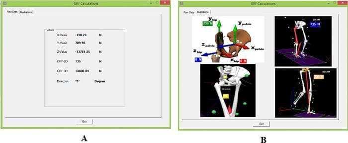 This composite image illustrates the biomechanical analysis of Ground Reaction Forces (GRF) at the hip joint using specialized AQHF software. Panel A displays a 'Raw Data' window showing numerical outputs for force components including X, Y, and Z values in Newtons (N), alongside 2D and 3D GRF resultants and a vector direction of 75 degrees. Panel B provides a graphical representation of this data through anatomical diagrams of the pelvis and femur. It highlights two distinct coordinate systems: the pelvic frame (x_pelvic, y_pelvic, z_pelvic) and the hip frame (x_hip, y_hip, z_hip), with force vectors (735 N and 0 N) mapped onto these axes. Additional panels in B show 2D and 3D JRF (Joint Reaction Force) visualizations on a skeletal model during a simulated gait phase. This material is designed for orthopedic biomechanics education, focusing on hip joint kinetics, prosthetic design considerations, and gait analysis during single-limb support.