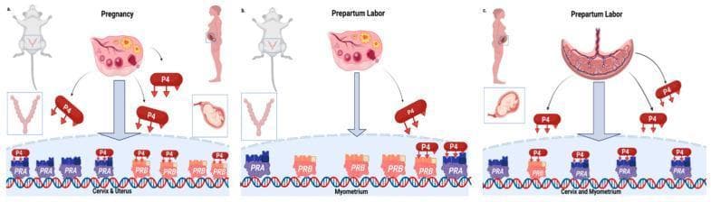 A comparative pathophysiology diagram illustrating progesterone (P4) signaling mechanisms during pregnancy and parturition in murine and human models. The figure is divided into three sections: (a) Pregnancy (common to both), (b) Prepartum Labor in mice, and (c) Prepartum Labor in women. Each panel depicts reproductive anatomy (ovaries, uterus, fetus) alongside molecular mechanisms involving genomic nuclear progesterone receptor isoforms PR-A and PR-B bound to DNA. In the 'Pregnancy' state, P4 is shown actively binding to both PR-A and PR-B receptors in the cervix and uterus to maintain gestation. Panel (b) illustrates 'actual' progesterone withdrawal in mice, where systemic P4 levels decline, leading to reduced receptor binding and labor onset. Panel (c) illustrates 'functional' progesterone withdrawal in women, where systemic P4 levels remain high, but changes in the ratio and distribution of PR-A and PR-B within the cervix and myometrium modulate the tissue response to trigger parturition. The diagram highlights the differing roles of hormonal versus receptor-level changes between species.