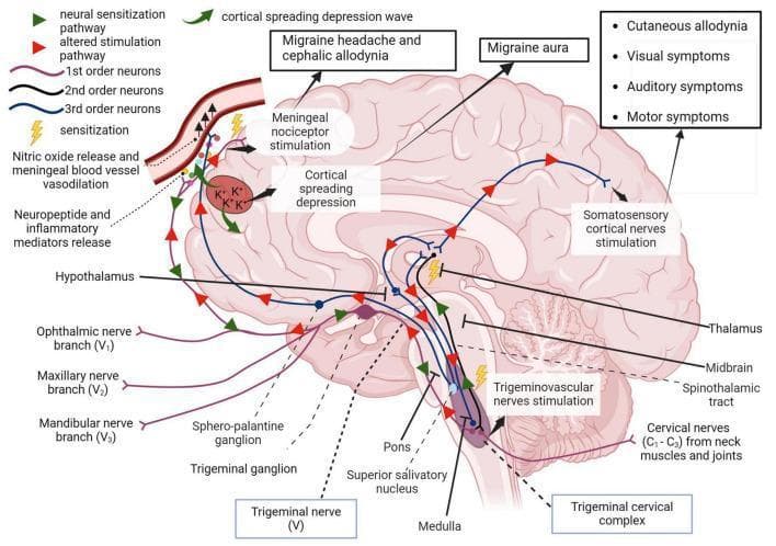 A pathophysiology diagram illustrating the trigeminovascular pathway and its role in migraine development. The diagram depicts a sagittal view of the human brain, highlighting key anatomical structures including the trigeminal ganglion, trigeminal cervical complex (medulla/pons), thalamus, hypothalamus, and somatosensory cortex. It maps the neural hierarchy from 1st-order neurons (trigeminal branches V1, V2, V3 and cervical nerves C1-C3) through the 2nd-order spinothalamic tract to 3rd-order thalamic projections. Visual indicators identify areas of sensitization and altered stimulation pathways. Key educational concepts include the cortical spreading depression wave, meningeal nociceptor stimulation, and neuropeptide release leading to vasodilation. The diagram correlates specific neural activity with clinical symptoms, specifically migraine aura, cephalic and cutaneous allodynia, and visual, auditory, and motor impairments. It further demonstrates the descending pathway via the superior salivatory nucleus involving nitric oxide release in meningeal blood vessels, providing a comprehensive visual of central and peripheral sensitization in migraine pathology.