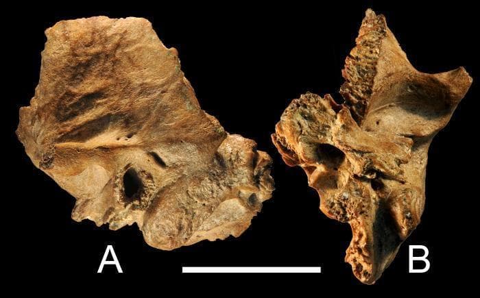 This osteological clinical specimen displays two views of the Xujiayao 15 left temporal bone, representing late archaic human anatomy. View A (lateral) shows the squamous and mastoid portions, highlighting a well-preserved external auditory canal and mastoid process. Key anatomical features include the absence of the zygomatic process and minor chips along the squamous suture. Antero-superiorly, the specimen shows evidence indicative of a prior sutural bone. View B (inferior) provides a perspective of the petrous portion and the skull base surface. This view demonstrates that the medial petrous tip is missing, while the tympanic bone and the inferior aspect of the auditory canal remain largely intact. The specimen exhibits minor osseous changes, specifically Grade 1 External Auditory Exostoses (EAE) characterized by small knobs of bone and surface irregularities along the posterior and posteroinferior tympanic bone, suggesting chronic inflammation or environmental exposure.
