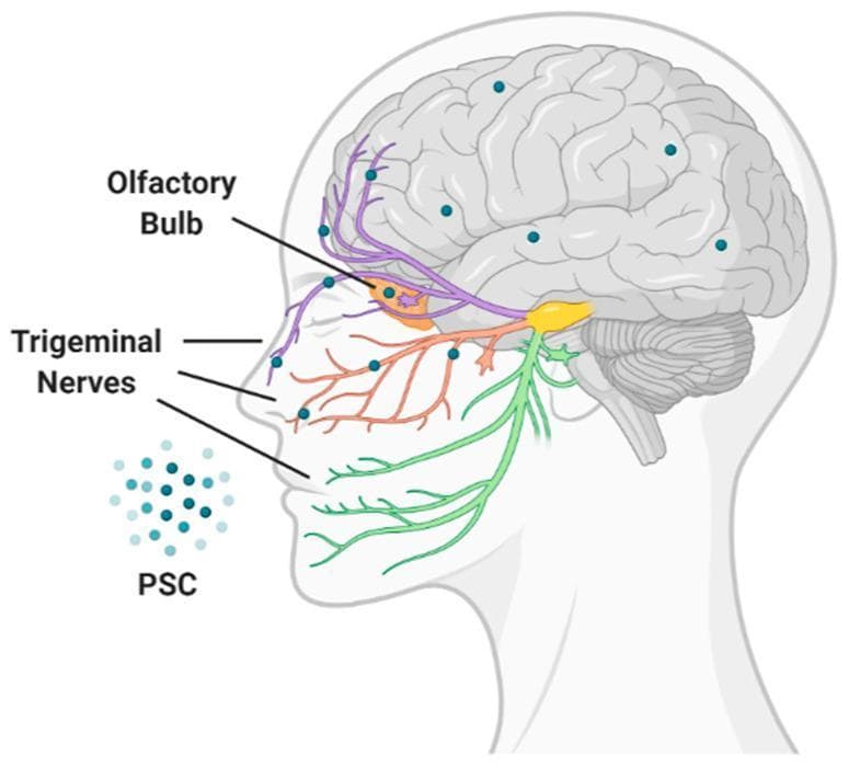 This medical anatomical diagram illustrates the nose-to-brain drug delivery route for Polysaccharide-based Carriers (PSC). The diagram shows a sagittal profile of a human head with the brain and neurological pathways highlighted. The drug, represented as teal dots (PSC), is shown entering through the nasal cavity. Two primary pathways are depicted for direct central nervous system access, bypassing the blood-brain barrier: the olfactory pathway (indicated in purple), originating from the olfactory bulb at the base of the frontal lobe, and the trigeminal nerve pathway (indicated in orange/green), showing the ophthalmic and maxillary branches providing a conduit from the nasal mucosa to the brainstem and higher brain regions. Small teal dots distributed throughout the cerebral cortex and cerebellum represent the subsequent distribution of the therapeutic agent within the brain tissue. This illustration is used to explain non-invasive administration strategies for treating neurological diseases and the pharmacological advantage of utilizing cranial nerve pathways for targeted brain delivery.