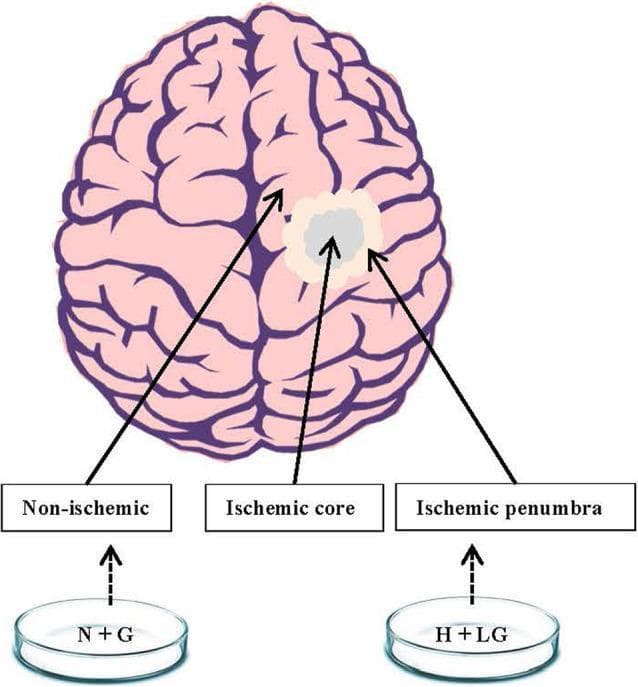 A schematic diagram illustrating the pathophysiology of ischemic stroke and corresponding in vitro experimental models. The central feature is a superior view of the human brain, depicted with pink-colored gyri and sulci. This illustration highlights three distinct clinical zones following a cerebrovascular accident: the 'Ischemic core' (indicated by a gray central circle representing irreversible tissue necrosis), the surrounding 'Ischemic penumbra' (shown as a white halo representing potentially salvageable tissue), and the remaining 'Non-ischemic' healthy regions (pink). Below the brain, the diagram links these clinical states to laboratory cell culture models. An 'N+G' (Normoxia + Glucose) petri dish is correlated with the non-ischemic region, serving as the experimental control. An 'H+LG' (Hypoxia + Low Glucose) petri dish is correlated with the ischemic penumbra, illustrating the experimental strategy to mimic penumbral conditions in HT22 cells to study neuroprotective mechanisms and cellular survival factors like HIF1α.