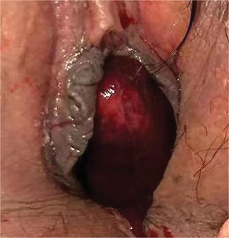 Hugging Face pmc clinical VQA raw