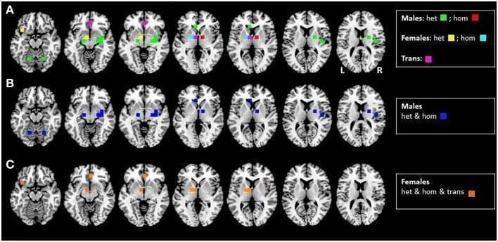 A diagnostic functional neuroimaging visualization presenting axial brain slices organized into three horizontal rows (A, B, and C). The images illustrate neural activation patterns in response to a pheromone-like compound (AND), mapped using positron emission tomography (PET) data. Row A demonstrates comparative activations based on sex and sexual orientation, with colored 10 mm spheres indicating specific groups: green for heterosexual males, red for homosexual males, yellow for heterosexual females, cyan for homosexual females, and magenta for male-to-female transsexuals. Row B shows aggregated sex-specific activation for both heterosexual and homosexual males in blue. Row C displays combined activation for heterosexual females, homosexual females, and male-to-female transsexuals in orange. The slices are oriented in a standard radiological view with 'L' and 'R' markers visible in the far-right panel of row A. The visualization highlights distinct cortical and subcortical areas of activation, including the hypothalamus and limbic regions, providing clinical insight into the neurobiology of sexual orientation and gender identity.