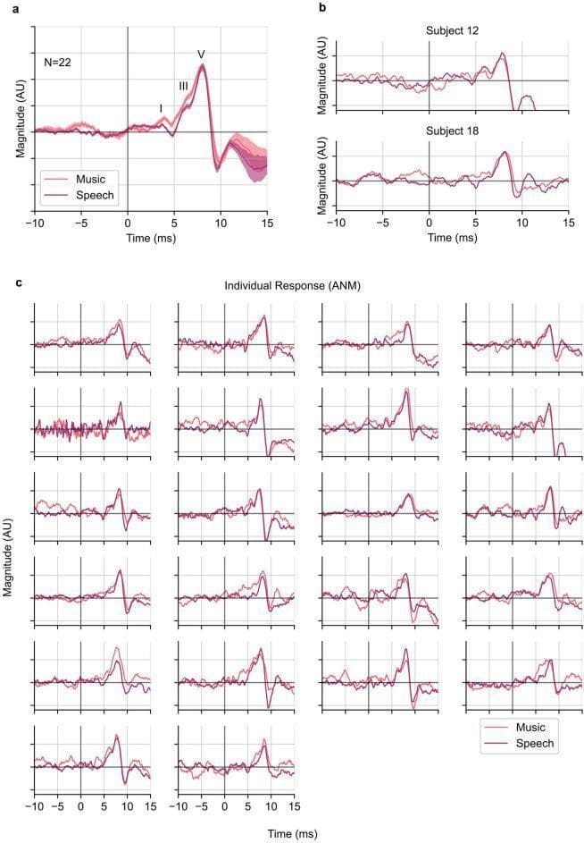 This figure presents Auditory Brainstem Response (ABR) waveforms evoked by music and speech stimuli, derived using an Auditory Nerve Modeled (ANM) regressor. Panel (a) shows the grand average waveforms for 22 subjects, with Magnitude (AU) on the y-axis and Time (ms) ranging from -10 to 15 on the x-axis. The canonical ABR components—Wave I (cochlear nerve), Wave III (superior olivary complex), and Wave V (inferior colliculus)—are clearly annotated and identifiable for both music (pink) and speech (dark red) at typical latencies, with Wave V peaking around 7.5–8.1 ms. Panel (b) provides example individual responses for Subjects 12 and 18, demonstrating subject-level variation. Panel (c) displays a 6x4 grid of individual ABR waveforms for all participants, illustrating that while Wave V is consistently robust across all subjects, the clarity of Waves I and III varies. These diagnostic plots demonstrate that accounting for peripheral nonlinearities through ANM modeling reveals a high degree of subcortical encoding similarity between music and speech stimuli.