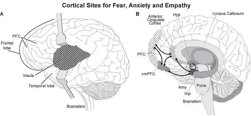 This medical illustration presents two anatomical diagrams of the human brain focused on the neurobiology of fear, anxiety, and empathy. Diagram A is a lateral view showing the retraction of the frontal and temporal lobes to reveal the insula, which is highlighted with cross-hatching. The Prefrontal Cortex (PFC) and brainstem are also labeled. Diagram B is a mid-sagittal section illustrating deep cortical and subcortical structures. It highlights the Anterior Cingulate Cortex (ACC) and the ventromedial Prefrontal Cortex (vmPFC) with cross-hatching. Key labeled subcortical structures include the corpus callosum, hypothalamus (Hyp), amygdala (Amy), hippocampus (Hip), pons, and brainstem. Black bidirectional arrows indicate functional connectivity and reciprocal pathways between the PFC, vmPFC, amygdala, and hippocampus. This anatomical diagram serves to educate on the limbic system's circuitry and the integration of cortical sites with subcortical emotional processing centers.