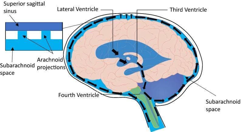 This medical anatomical diagram illustrates the conventional physiological pathway of cerebrospinal fluid (CSF) flow within the central nervous system. The illustration features a sagittal view of the human brain and spinal cord, with arrows indicating the unidirectional movement of CSF. The pathway begins with CSF production in the lateral ventricles, moving through the third and fourth ventricles. From the ventricular system, CSF enters the subarachnoid space, where it circulates around the external surfaces of the brain and extends down the spinal canal. A magnified inset detailed at the top left demonstrates the mechanism of CSF drainage, showing the relationship between the subarachnoid space and the superior sagittal sinus. This process is mediated by arachnoid projections (arachnoid villi/granulations), which allow CSF to be reabsorbed into the venous blood of the dural venous sinus. Key labeled structures include the lateral, third, and fourth ventricles, the subarachnoid space, and the superior sagittal sinus. This diagram serves as an educational resource for neuroanatomy and neurophysiology, specifically regarding intracranial pressure regulation and the glymphatic system context.