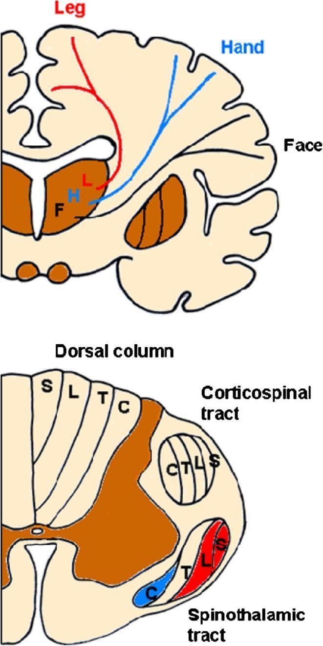This medical illustration depicts the somatotopic organization (functional mapping) of the human spinothalamocortical system through two anatomical sections. The upper diagram shows a coronal section of the brain, highlighting the thalamocortical fibers. It demonstrates the sensory homunculus where fibers for the face (F) diverge laterally from a medial thalamic position, while fibers for the leg (L) ascend vertically near the lateral ventricle. The lower diagram presents an axial section of the cervical spinal cord, comparing the lamination of major white matter tracts. The dorsal column exhibits a medial-to-lateral arrangement from sacral (S) to cervical (C) fibers. Conversely, both the corticospinal and spinothalamic tracts show an inverse somatotopy where cervical fibers (C) are positioned medially/internally and sacral fibers (S) are positioned laterally/superficially near the spinal cord surface. This educational graphic illustrates the varying spatial relationships of fibers representing different body regions as they ascend or descend the central nervous system.