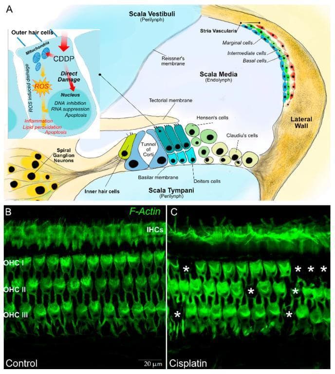 Educational medical composite depicting the anatomy and pathophysiology of the mammalian cochlea and ototoxicity. Panel A is an anatomical diagram showing a transverse section of the cochlear duct, labeling the scala vestibuli, scala media (containing endolymph), and scala tympani. Key structures include the organ of Corti with inner hair cells (IHC), three rows of outer hair cells (OHC), the tectorial membrane, stria vascularis, and spiral ganglion neurons. An inset illustrates the mechanism of cisplatin (CDDP) ototoxicity, highlighting reactive oxygen species (ROS) production, mitochondrial damage, and apoptosis. Panels B and C are fluorescence microscopy images of surface preparations of the organ of Corti stained for F-actin (green), visualizing stereociliary arrays and cuticular plates. Panel B (control) displays a highly organized single row of IHCs and three parallel rows of OHCs. Panel C (cisplatin-treated) demonstrates pathological hair cell loss, indicated by asterisks highlighting gaps in the OHC rows. This visual serves to teach the cellular organization of the auditory system and the mechanism of drug-induced sensorineural hearing loss.