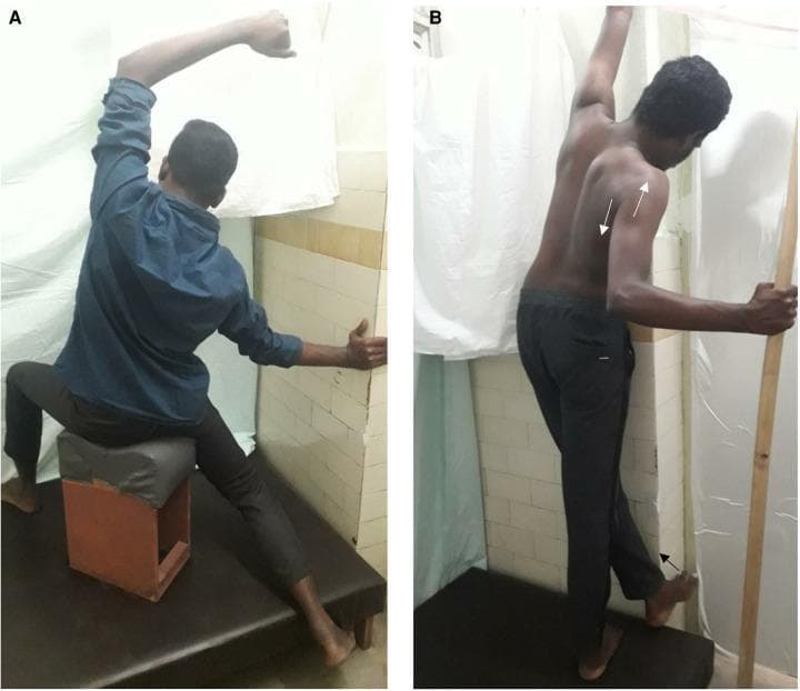 Two-panel clinical photograph demonstrating curve-specific correction exercises for adolescent idiopathic scoliosis (AIS). Panel A (Sitting): The subject is seated on a raised platform with asymmetrical lower limb positioning. The right leg is abducted and extended while the left knee is flexed. The torso displays ipsilateral lateral flexion with the right arm elevated overhead and the left arm abducted against a wall for support. Panel B (Standing): The subject is standing with the right leg slightly posterior and the left foot elevated against a wall. The left arm is adducted with the scapula protracted and rotated, while the right hand stabilizes against a vertical pole. White arrows indicate corrective vectors for thoracic and lumbar shift. These postural maneuvers aim to achieve sagittal and transverse plane correction of spinal deformities and pelvic obliquity. These therapeutic exercises are common in the Schroth method or similar physiotherapy protocols for scoliosis management.