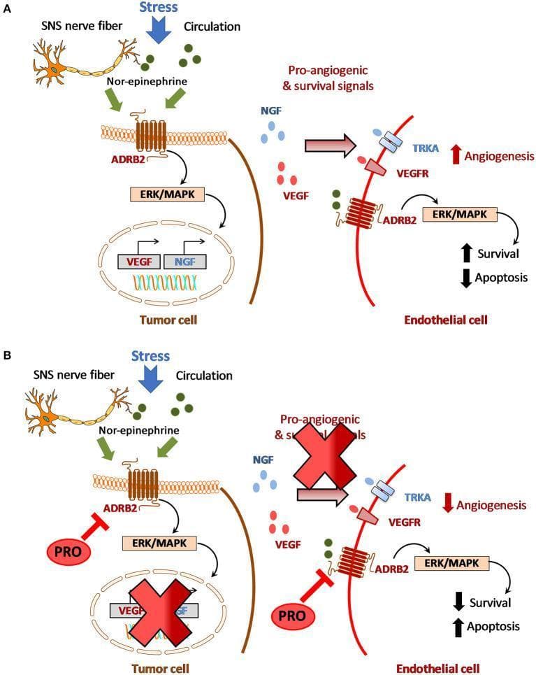 This pathophysiology diagram illustrates the crosstalk between adrenergic signaling and angiogenesis in the tumor microenvironment, specifically in Head and Neck Squamous Cell Carcinoma (HNSCC). Panel A depicts a stimulatory pathway where stress triggers Nor-epinephrine release from SNS nerve fibers or circulation. This activates beta-2 adrenergic receptors (ADRB2) on tumor cells, signaling via ERK/MAPK to upregulate VEGF and NGF. These pro-angiogenic factors bind to TRKA and VEGFR on endothelial cells, stimulating angiogenesis and survival while inhibiting apoptosis. Panel B presents a hypothetical therapeutic model using Propranolol (PRO), a non-selective beta-blocker. PRO binds to ADRB2 on both tumor and endothelial cells, effectively blocking the adrenergic signaling cascade. This inhibition results in suppressed expression of pro-angiogenic signals, leading to reduced angiogenesis, decreased cell survival, and increased apoptosis of endothelial cells. The diagram highlights the potential for targeting the adrenergic-angiogenic axis to disrupt tumor neovascularization and disease progression.
