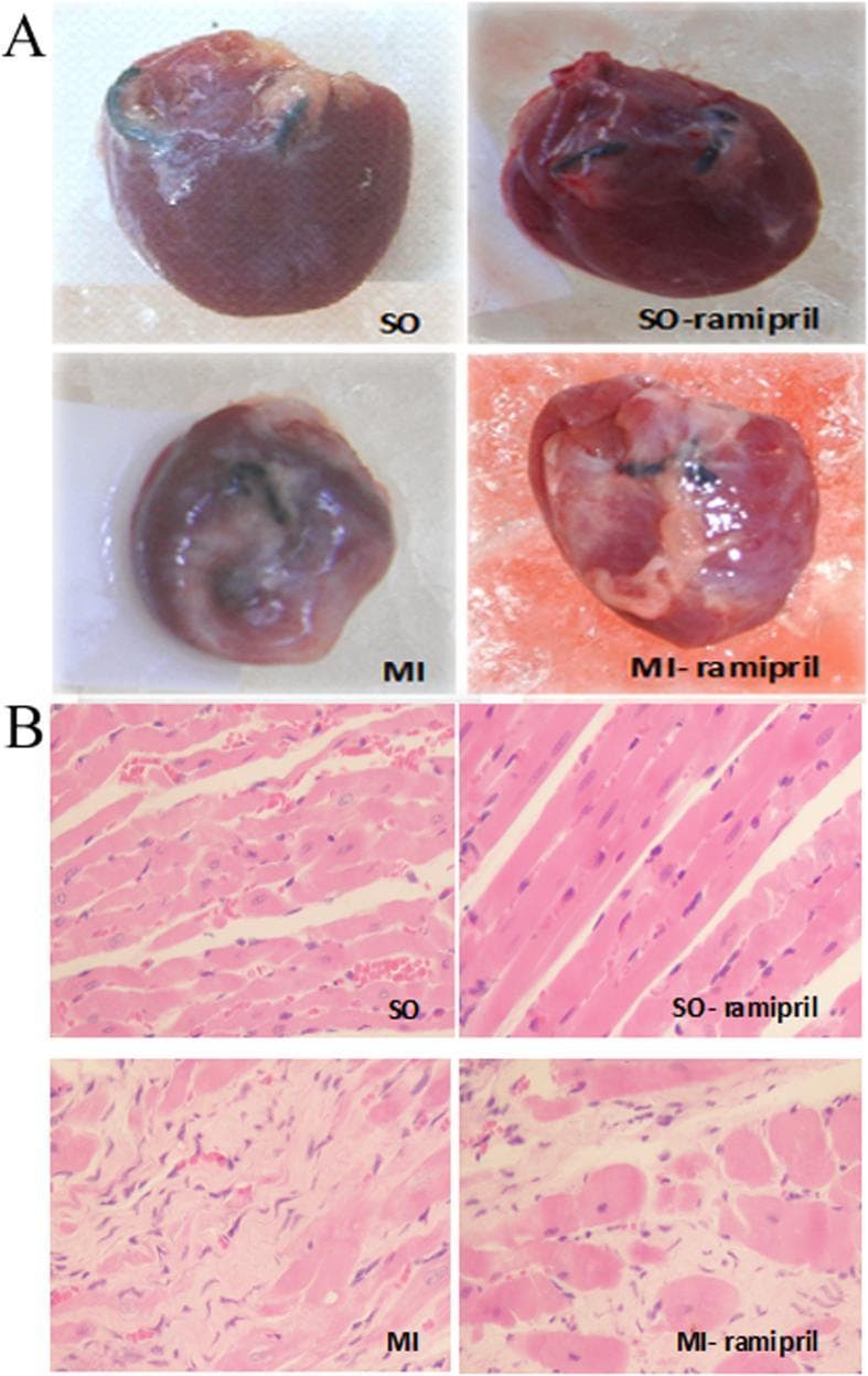 This composite educational image illustrates the gross morphology and histopathology of myocardial infarction (MI) and the effects of ramipril treatment in a rat model. Panel A presents a comparison of gross heart specimens. The Sham-Operated (SO) group shows a healthy ellipsoid shape with a smooth, dark-red surface. In contrast, the MI group exhibits significant ventricular enlargement (eccentric hypertrophy), a pale infarcted region, and thinning of the ventricular wall. The MI-ramipril group demonstrates a moderate reduction in heart volume and infarct size compared to the untreated MI group. Panel B displays light microscopy of myocardial tissue stained with Hematoxylin and Eosin (H&E). The SO groups show organized, parallel myocardial fibers with intact cardiomyocytes and clear nuclei. The untreated MI group reveals significant pathological changes in the non-infarcted area, including irregular fiber arrangement, cardiomyocyte hypertrophy, and evidence of interstitial fibrosis and degeneration. The MI-ramipril specimen shows partially preserved fiber architecture and less severe cardiomyocyte degeneration, highlighting the cardioprotective effects of ACE inhibition on post-MI remodeling.