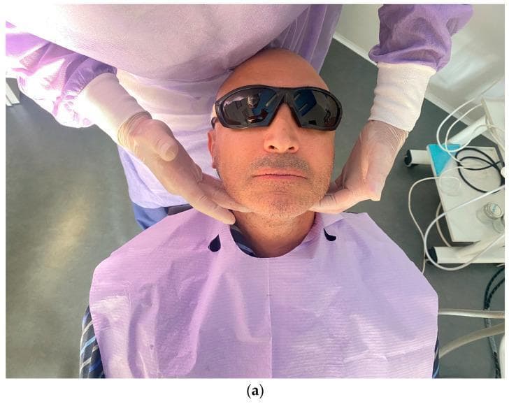 This clinical photograph demonstrates an extraoral examination of the submandibular and cervical lymph nodes. The patient is positioned seated and reclined, wearing protective eyewear and a lavender dental bib. A clinician, donned in a lavender surgical gown and light-colored gloves, is shown performing manual palpation by placing their hands bilaterally along the patient's jawline and upper neck area. This procedure is a critical component of a comprehensive head and neck examination in dental and oral surgery contexts, used to detect lymphadenopathy or signs of inflammatory processes related to dental implants or oral infections. The image highlights the correct hand positioning for systematic palpation of the facial and neck soft tissues.