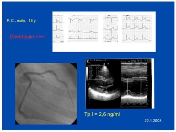 Hugging Face pmc clinical VQA raw