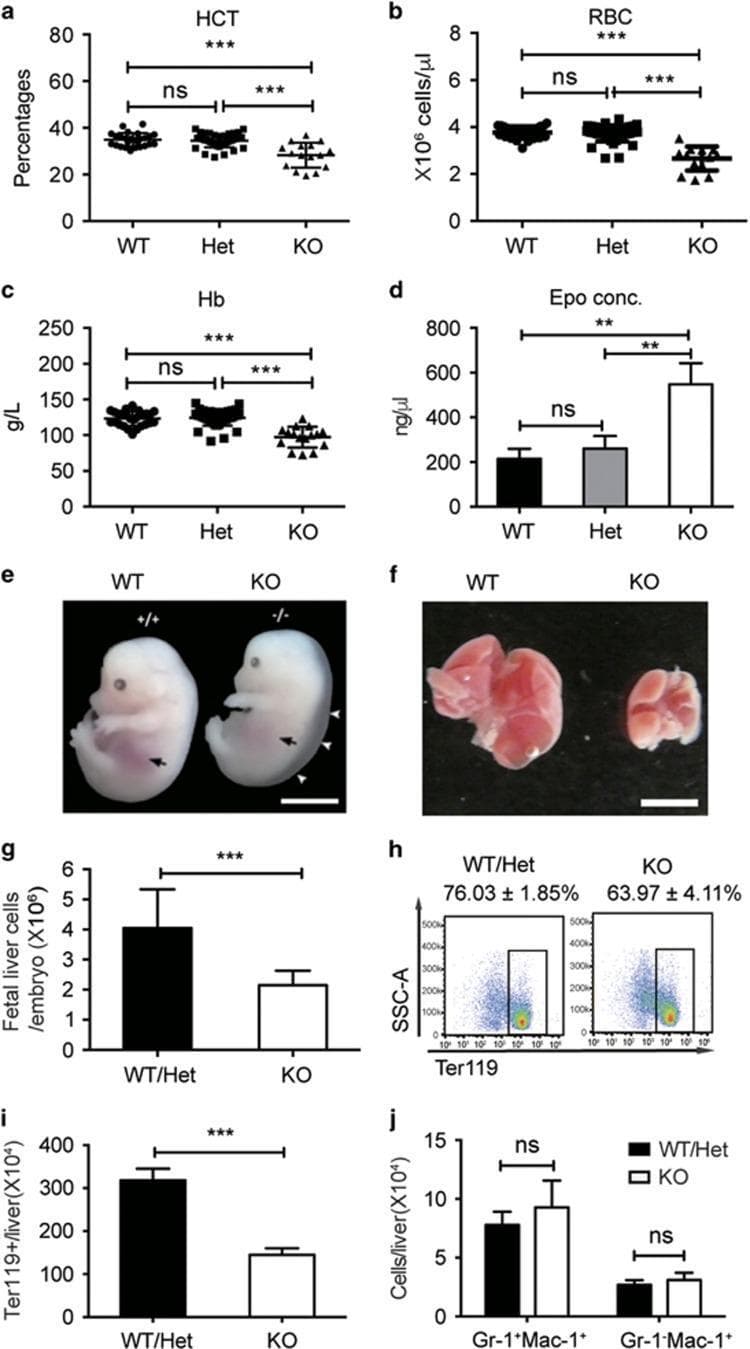 This composite educational image illustrates the hematopoietic and morphological effects of Stk40 knockout (KO) in mouse embryos. (a-d) Scatter and bar graphs display hematological indices: the KO group shows a significant reduction in hematocrit (HCT), red blood cell (RBC) count, and hemoglobin (Hb) concentration, while erythropoietin (Epo) levels are significantly elevated compared to wild-type (WT) and heterozygous (Het) controls. (e) Comparative clinical photographs of E14.5 embryos show that the Stk40 KO embryo exhibits severe subcutaneous edema (white arrowheads) and a diminished fetal liver shadow (black arrows) relative to the WT. (f) Macroscopic images of harvested fetal livers demonstrate marked hypoplasia in the KO liver compared to the WT. (g-j) Quantitative analysis and flow cytometry data show a decrease in total fetal liver cellularity and absolute numbers of Ter119+ erythroid cells in KO embryos, indicating impaired definitive erythropoiesis. Collectively, the data demonstrate that Stk40 deficiency leads to fetal anemia, edema, and hepatic hematopoietic defects.