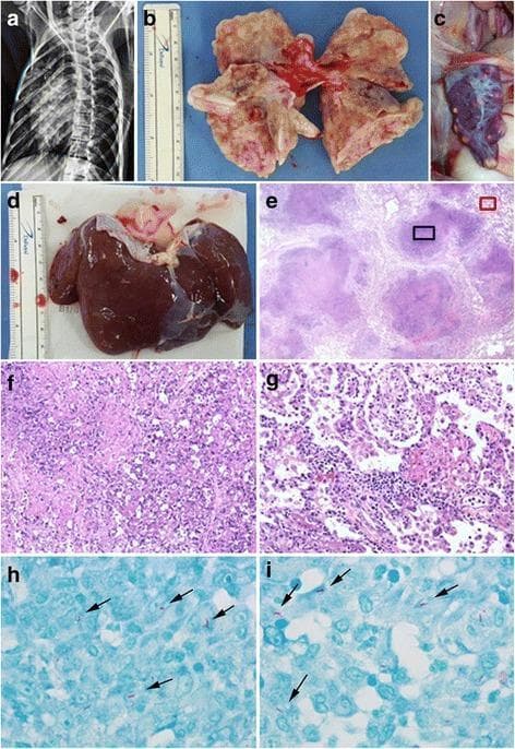 This composite figure illustrates the multi-organ manifestations of Mycobacterium tuberculosis in a primate model, showcasing diagnostic imaging, gross pathology, and histopathology. Panel (a) is a chest radiograph showing diffuse pulmonary infiltrates. Panels (b), (c), and (d) present gross pathology of the lungs, spleen, and liver respectively, highlighting numerous pale, nodular granulomatous lesions across the organ surfaces. Panels (e), (f), and (g) are Hematoxylin and Eosin (H&E) stained sections of lung tissue at varying magnifications (12.5x to 200x). They demonstrate classic granulomatous inflammation with central amorphous caseous necrosis and surrounding inflammatory cell infiltration. Panels (h) and (i) show high-magnification (1000x) Ziehl-Neelsen stains of the lung tissue, specifically identifying several acid-fast bacilli (AFB) visible as small, bright red-pink rods (indicated by arrows) against a blue methylene counterstain. This progression from clinical radiology to microscopic confirmation of AFB and caseating granulomas illustrates the typical diagnostic pathway for systemic tuberculosis.