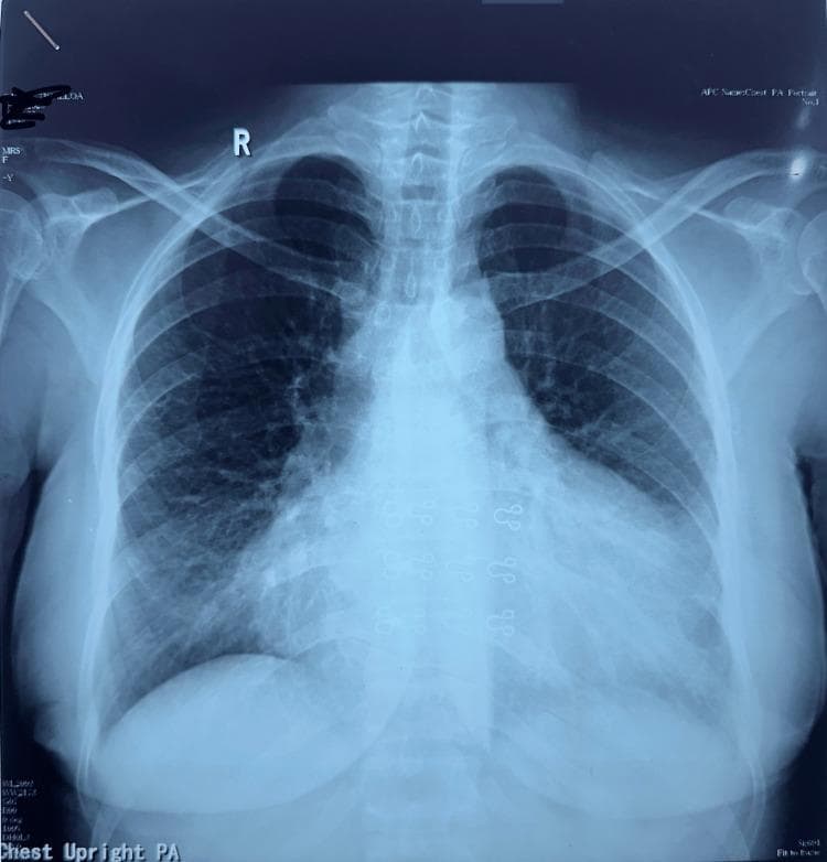 Hugging Face pmc clinical VQA raw