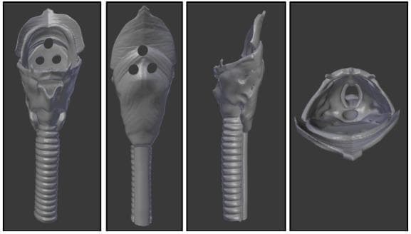 Anatomical Diagram/3D Model: This image displays a grey-scale 3D digital rendering of a pediatric throat piece designed for a medical simulation model, shown in four standard orientations: anterior, posterior, lateral, and cranial-caudal (superior) views. The model illustrates the essential upper airway anatomy required for Endotracheal Intubation (ETI) training. The anterior and lateral views highlight the distal trachea characterized by prominent horizontal ridges representing tracheal rings. The proximal portion includes the laryngeal structures and esophagus, featuring three circular registration holes for assembly with a head unit. The cranial-caudal view provides an internal perspective of the airway, depicting an oval-shaped glottic opening and vocal cord structures surrounded by simulated soft tissues. This model is constructed from flexible materials to mimic the tactile feel of human tissue, serving as a pedagogical tool for medical students and clinicians to practice airway management and recognize key anatomical landmarks such as the larynx, trachea, and esophagus.