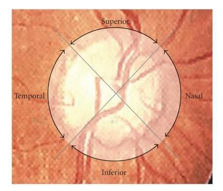 This diagnostic schematic illustrates the methodology for peripapillary retinal nerve fiber layer (RNFL) thickness measurement using Optical Coherence Tomography (OCT). The visual features a fundus photograph centered on the optic disc, overlaid with a 360-degree circular scan path measuring 3.4 mm in diameter. Two intersecting diagonal lines divide the circular scan area into four distinct anatomical quadrants labeled as Superior, Inferior, Nasal, and Temporal. The bright, central region of the image corresponds to the optic nerve head, with visible retinal vasculature emerging and radiating toward the periphery. This diagram demonstrates how OCT software segments the peripapillary region to calculate mean and quadrant-specific RNFL thickness, a critical metric in the clinical assessment and monitoring of glaucoma and other optic neuropathies. The educational focus is on the spatial orientation and standardized partitioning of retinal imaging for diagnostic data acquisition.
