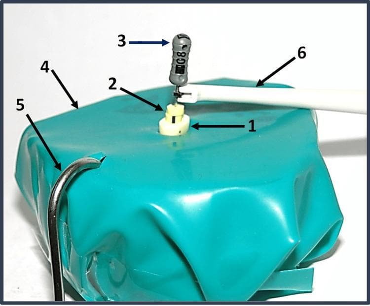 A clinical photograph of an in vitro endodontic experimental setup designed for electronic apex locator testing. The image shows a decoronated human premolar (1) embedded in a porous block saturated with Ringer’s solution to simulate clinical conductivity. A size 8 K-file (3) with a grey handle is inserted into the root canal system, featuring two light yellow cylindrical double stoppers (2) used as reference points for canal length measurement. The experimental model is draped with a turquoise rubber dam sheet (4). Integrated into the circuit are two essential electronic apex locator components: a metal lip clip (5) hooked into the dam and a white file clip (6) connected to the cervical aspect of the K-file. This setup demonstrates the procedural assembly for measuring actual versus electronic working length in a laboratory setting, simulating the electrical resistance of human periodontal tissues.