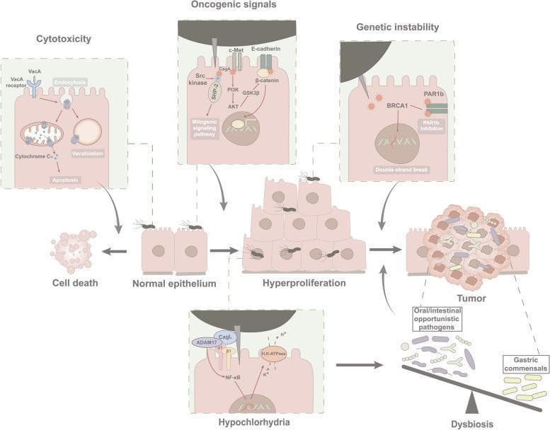 This pathophysiology diagram illustrates the 'hit and run' mechanism of Helicobacter pylori-induced gastric carcinogenesis. The central flowchart depicts the progression from normal epithelium to hyperproliferation and eventual tumor formation, accompanied by gastric dysbiosis. Detailed callouts outline four specific mechanisms: 1) Cytotoxicity: VacA binding and endocytosis leading to mitochondrial cytochrome C release, vacuolation, and apoptosis. 2) Oncogenic Signaling: CagA translocation via Type IV Secretion System (T4SS), involving Src kinase-mediated mitogenic signaling, c-Met/PI3K/AKT activation, and E-cadherin/beta-catenin disruption (Wnt signaling). 3) Genetic Instability: CagA-mediated PAR1b inhibition and BRCA1 interference leading to DNA double-strand breaks. 4) Hypochlorhydria: CagL interaction with integrins and ADAM17, inhibiting H,K-ATPase via NF-kB to cause gastric acid hyposecretion. These molecular pathways contribute to cellular transformation, genetic instability, and an altered microbial environment (dysbiosis) where opportunistic pathogens outcompete gastric commensals, promoting a persistent tumor phenotype.