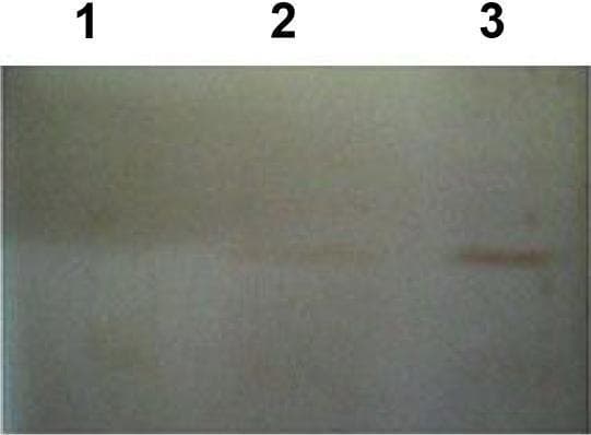 A Western blot diagnostic image used to confirm the expression of a recombinant protein derived from the Echinococcus granulosus (hydatid cyst) Iranian G1 strain. The blot consists of three vertical lanes set against a light, uniform background. Lane 1 (negative control) contains bacterial lysate without a plasmid, showing no visible bands. Lane 2 contains bacterial lysate with a plasmid lacking the recombinant insert, exhibiting only a very faint, indistinct signal. Lane 3 (positive sample) demonstrates a distinct, high-intensity horizontal dark band, indicating successful expression of the targeted recombinant protein. This molecular biology technique is utilized in clinical research to validate antigen production for diagnostic assays, such as ELISA, for human hydatid disease. The clear visibility in Lane 3 compared to the controls confirms the presence and specificity of the recombinant antigen.