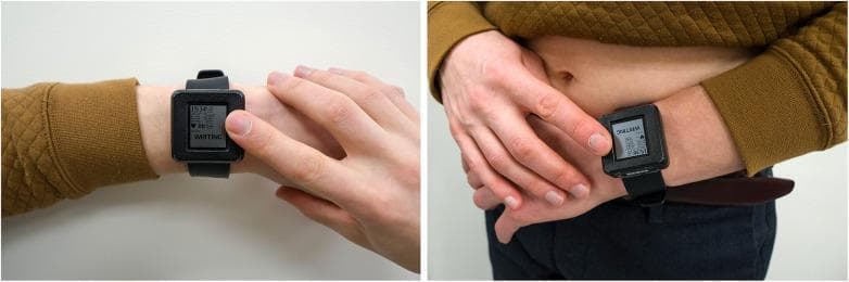 Clinical photograph showing two methods of acquiring electrocardiogram (ECG) data using a prototype wrist-worn wearable device. The device features a square digital display and integrated dry electrodes for wire-free recording. The left panel illustrates a single-lead ECG acquisition where the patient places their contralateral index finger on a top-facing electrode while the device is worn on the wrist, creating a Lead I-like circuit. The right panel demonstrates a six-lead ECG acquisition technique; here, the patient presses the device (worn on the wrist) against the skin of the lower abdomen/thigh area. This configuration utilizes three distinct contact points: one on the inner surface of the device against the wearing wrist, one on the top enclosure touched by the finger, and a third on the device's bracelet or rear sensor against the torso. The screen displays real-time status indicators including heart rate and data logging confirmation ('WRITING'). This technology aims to provide clinical-grade multi-lead cardiac monitoring, such as identifying atrial fibrillation (AF), in a mobile, user-operated format.