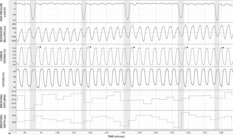 This physiological trace diagram displays multiple respiratory and gas exchange parameters recorded over approximately two minutes and forty seconds during an experimental study on inspiratory resistance. The figure is organized into six vertically stacked panels: inspiratory pressure (cmH2O), respiratory bellows (arbitrary units), carbon dioxide (%), oxygen (%), breathing rate (BPM), and breathing depth (au). Five vertical gray bars indicate periods where an external inspiratory resistance of 55 cmH2O was applied. During these resistance periods, the 'Inspiratory Pressure' trace shows significant negative deflections, reaching approximately -15 cmH2O, reflecting increased inspiratory effort. The 'Carbon Dioxide' trace reveals rhythmic oscillations corresponding to the respiratory cycle; asterisks (*) are placed above the peaks immediately following each gray period to highlight an increase in end-tidal carbon dioxide (PETCO2). The 'Oxygen' trace shows inverse oscillations to CO2. The bottom panels utilize step-graphs to track dynamic changes in breathing frequency and volume (depth). This visualization demonstrates the acute physiological and compensatory responses of the respiratory system to sudden, external mechanical loads.