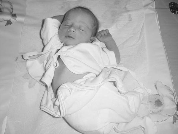 This clinical photograph shows a newborn infant in a supine position, representing standard neonatal care and attire within a maternity ward setting. The infant is dressed in a light-colored, long-sleeved cotton shirt and matching leggings. The shirt is designed with a side-tie closure, currently open at the abdomen to allow for clinical observation or umbilical cord care. The infant appears in a relaxed, sleeping state with closed eyes and arms flexed toward the head, indicating normal neurological tone and comfort. The infant is placed on a flat, padded surface covered with a protective sheet, typical of a nursery changing station or bassinet. A plush toy is visible near the feet. This image serves to illustrate traditional postpartum care practices and the use of loose-fitting infant apparel as an alternative to swaddling in clinical research focused on early infant development and breastfeeding outcomes.