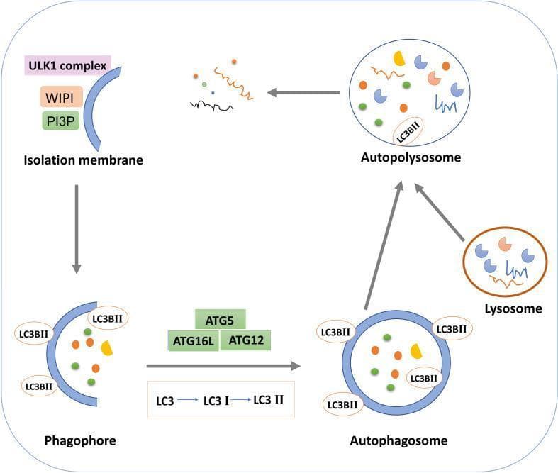 This pathophysiology diagram illustrates the sequential stages of macroautophagy, a critical cellular degradation pathway. The process initiates with the 'Isolation membrane' (pre-autophagosomal structure), mediated by the ULK1 complex involving WIPI and PI3P. This evolves into a crescent-shaped 'Phagophore' which sequester cytoplasmic components. The diagram highlights the elongation and maturation phase, showing the recruitment of the ATG12-ATG5-ATG16L1 complex and the lipidation of LC3 (converting LC3 I to LC3 II) to facilitate membrane closure. This results in the formation of a double-membraned 'Autophagosome' containing internal cargo and membrane-bound LC3BII. In the final phase, the autophagosome fuses with a 'Lysosome' containing hydrolytic enzymes to form an 'Autopolysosome' (autolysosome), where the sequestered material is degraded. Key molecular markers like LC3BII are depicted throughout the maturation steps. This illustration is relevant for teaching basic cell biology, molecular signaling, and pathophysiology in contexts like Diabetic Kidney Disease (DKD), where autophagic flux regulation is a therapeutic target.