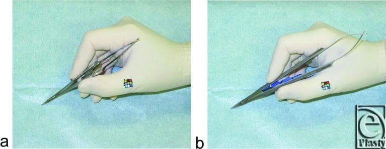 A side-by-side comparison of two surgical needle holders being held by a gloved hand, demonstrating ergonomic grip differences in surgical technique. Image (a) depicts a Webster needle holder, a traditional scissor-type instrument with finger rings and a ratcheted handle, held with a palm-in-hand or 'scissor grip' using the thumb and ring finger for stability. Image (b) shows a newly developed 19 cm pen-type needle holder, which is an enlarged version of a micro needle holder. It is held with a 'pen grip' or thenar grip, utilizing the thumb and index finger for fine motor control and precision. This comparison illustrates different ergonomic approaches to suturing, often used in plastic surgery and microsurgery to manage muscle fatigue and enhance needle manipulation during delicate procedures like skin or vessel closure. The clinical focus is on the instrumentation used for fine skin-suturing tasks and the resulting forearm muscle activity required for different holding methods.