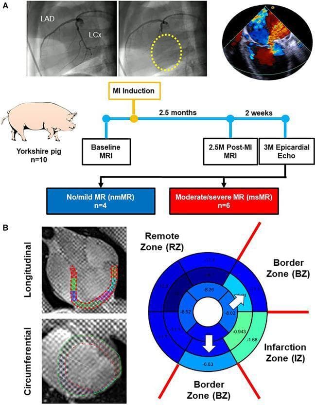 Educational medical composite depicting cardiac imaging analysis in a porcine model of myocardial infarction (MI). Figure A shows the experimental timeline: baseline MRI, MI induction via LCx artery occlusion, and follow-up cardiac MRI and epicardial echocardiography. Angiograms highlight the LAD and LCx coronary arteries. Figure B displays diagnostic images and data visualization of regional myocardial function. Left: Longitudinal and circumferential tagging cardiac MRI views with superimposed green and red myocardial contours for strain analysis. Right: A bull's-eye plot (17-segment model) representing peak strain distribution. The myocardial regions are categorized into three distinct areas: the Infarction Zone (IZ) in the inferolateral region (light green segments), the adjacent Border Zones (BZ) (cyan segments), and the healthy Remote Zone (RZ) (dark blue segments covering the remaining anterior and septal walls). The diagram illustrates spatial classification used to study differences in longitudinal and circumferential strain following ischemic injury and subsequent mitral regurgitation development.