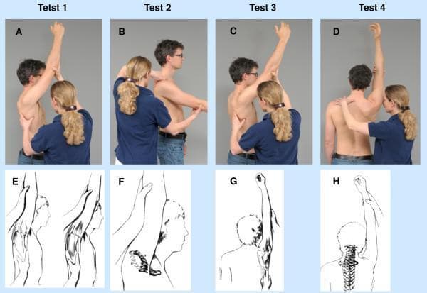 This composite educational graphic illustrates clinical mobility tests and biomechanical principles of the shoulder joint complex, specifically the Stenvers shoulder examination. Panels A-D are clinical photographs showing a practitioner performing manual assessments on a male subject. These include end-range flexion and abduction maneuvers with specific hand placements on the scapula, humerus, and acromioclavicular region to evaluate joint play and movement quality. Panels E-H provide corresponding anatomical diagrams. E compares lateral scapular positioning at end-range flexion between normal (left) and restricted (right) states, showing increased protraction in the latter. F details clavicular motion, contrasting normal posterior/dorsocranial trajectories (bold) with restricted movement patterns. G illustrates scapular posterior tilting during the terminal phase of flexion, and H depicts the associated motion of the cervicothoracic junction and spinal column. The content is designed for musculoskeletal physical therapy and orthopedic education, focusing on scapulohumeral rhythm, clavicular kinematics, and the identification of restricted range of motion in shoulder pathology.