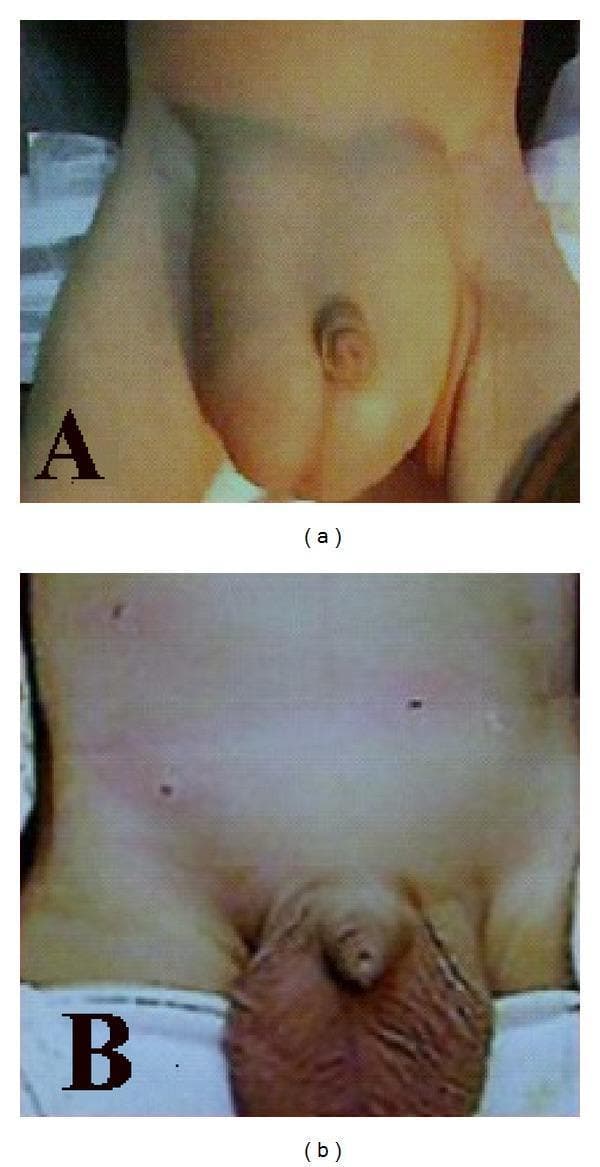 Hugging Face pmc clinical VQA raw