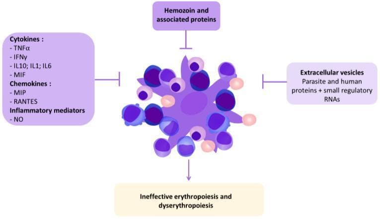 A pathophysiology diagram illustrating the human and parasite factors that contribute to malarial anemia. At the center is a complex cellular cluster, depicting a bone marrow erythroblastic island consisting of a central macrophage (dark purple, star-burst shape) surrounded by developing erythroblasts and red blood cells in various shades of purple and pink. Four key external factors are shown impacting this central unit via inhibitory or causal arrows: 1) Pro-inflammatory mediators (left) including cytokines (TNFΞ±, IFNΞ³, IL1, IL6, IL10, MIF), chemokines (MIP, RANTES), and nitric oxide (NO); 2) Hemozoin and associated parasite proteins (top); 3) Extracellular vesicles containing parasite/human proteins and regulatory RNAs/miRNAs (right); and 4) The resulting clinical outcome (bottom) categorized as ineffective erythropoiesis and dyserythropoiesis. The diagram uses a logical flow to explain how Plasmodium-induced systemic inflammation and parasite-derived products disrupt normal red blood cell production within the hematological system.