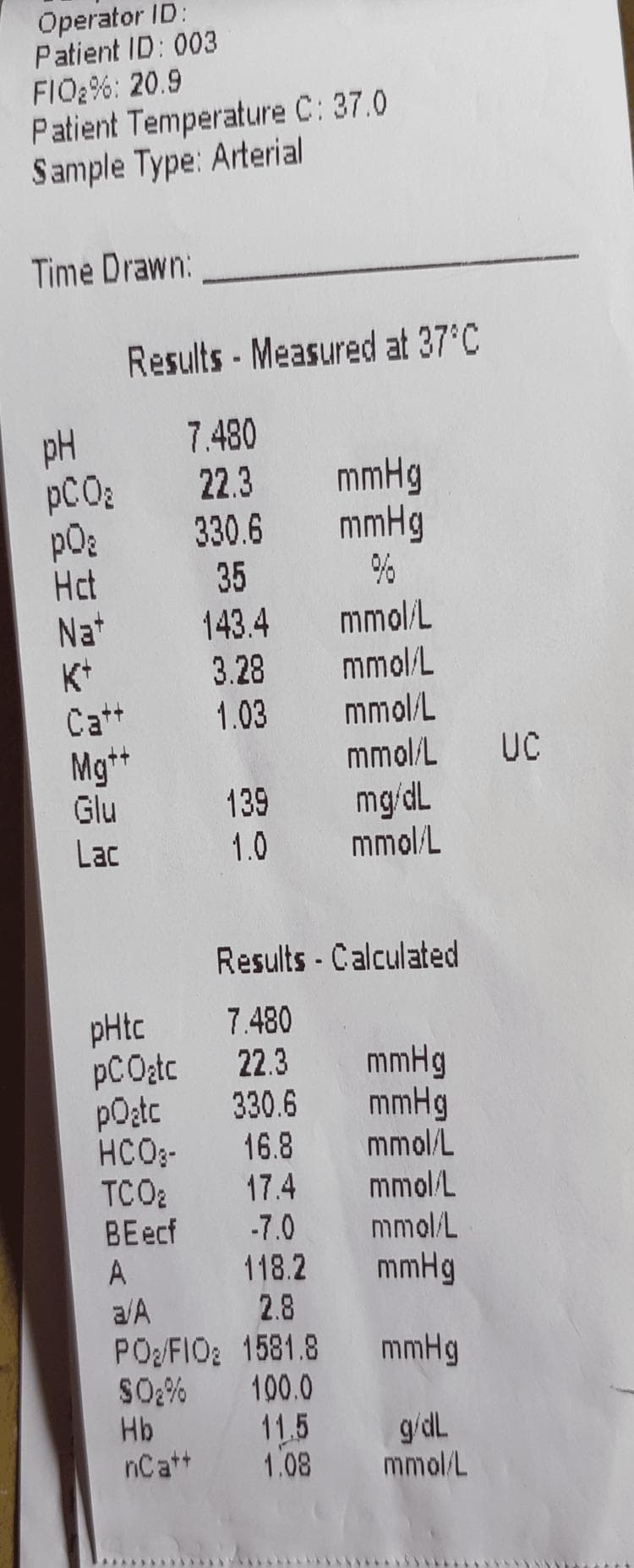 A clinical photograph of a printed arterial blood gas (ABG) analysis report. The document displays measured and calculated physiological values at a patient temperature of 37.0°C. Key measured values include a pH of 7.480, pCO2 of 22.3 mmHg, pO2 of 330.6 mmHg, and electrolyte levels (Na+ 143.4 mmol/L, K+ 3.28 mmol/L, Ca++ 1.03 mmol/L). Calculated values show a bicarbonate (HCO3-) level of 16.8 mmol/L and an oxygen saturation (SO2%) of 100.0%. This visual demonstrates a 'saturation gap' characteristic of certain toxicological conditions, such as methemoglobinemia, where the calculated oxygen saturation from the ABG appears normal (100%) despite the patient potentially experiencing clinical cyanosis and low peripheral pulse oximetry readings. The image is an educational tool for critical care, emergency medicine, and clinical toxicology, illustrating the interpretation of acid-base balance and oxygenation status.