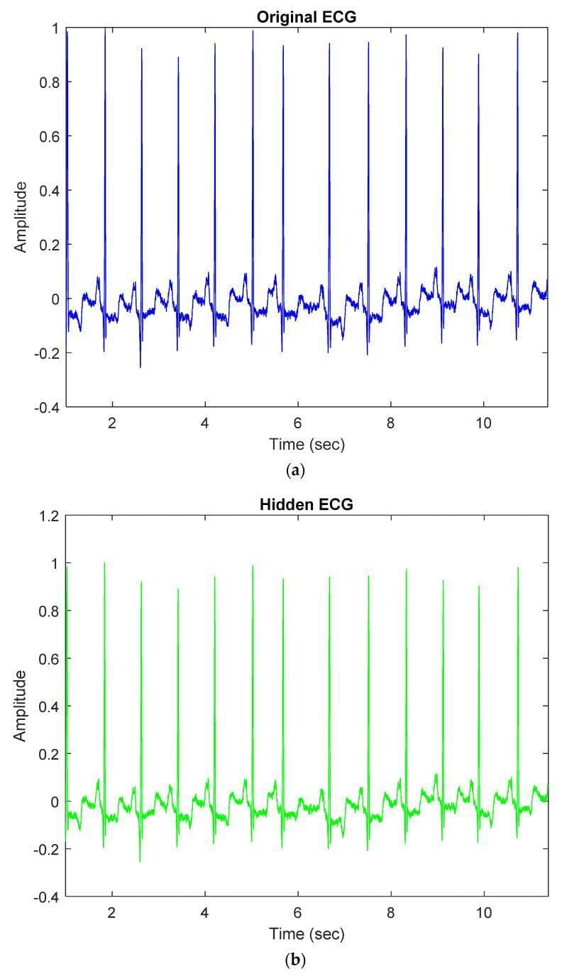 A multi-panel medical diagnostic graphic comparing an original electrocardiogram (ECG) signal with an embedded or 'hidden' ECG signal used for medical data steganography. Panel (a) displays a 10-second 'Original ECG' trace in blue, showing rhythmic cardiac cycles with prominent R-wave spikes, P-waves, and T-waves at a frequency of approximately 1 Hz (60 bpm) and an amplitude range of -0.2 to 1.0. Panel (b) shows the 'Hidden ECG' trace in green, which maintains the morphological integrity and clinical diagnostic features of the original signal despite the data embedding process. The comparison illustrates how clinical signals can be utilized as carriers for confidential patient information (such as name or medical history) via wavelet-domain optimization techniques. The focus is on demonstrating that the signal quality remains high enough for diagnostic interpretation after the embedding of metadata, with minimal visual distortion in the PQRST waveform components.