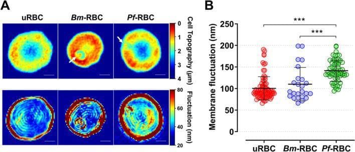 This medical visual consists of two parts: (A) qualitative 2D topographical and membrane fluctuation maps and (B) a quantitative dot plot, comparing uninfected red blood cells (uRBC) with those infected by Babesia microti (Bm-RBC) and Plasmodium falciparum (Pf-RBC).
The top row of panel A shows topographical height maps (scale 0–4 µm), where uRBCs display a typical biconcave profile. Bm-RBCs and Pf-RBCs exhibit altered morphology, with arrows indicating the presence of single merozoites within parasitophorous vacuoles. The bottom row presents membrane fluctuation maps (scale 20–80 nm), illustrating variations in cellular biomechanics. uRBCs show relatively low, uniform fluctuation (mostly blue), while infected cells, particularly Pf-RBCs, display significantly increased and heterogeneous fluctuation patterns (yellow and red areas).
Panel B is a statistical dot plot of mean membrane fluctuations in nanometers (nm). It confirms that Pf-RBCs have the highest membrane fluctuation (approximately 141.3 nm) compared to Bm-RBCs and uRBCs, with significant differences marked (***P < 0.001). This comparison highlights the biophysical changes induced by different intraerythrocytic parasites.