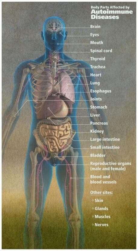 This medical infographic features a full-body anatomical diagram of a human figure titled Body Parts Affected by Autoimmune Diseases. The figure is rendered in a semi-transparent blue-toned style, revealing internal structures including the skeletal system, major organs, and a pink-colored vascular network. Labeled structures span the entire body, including the brain, eyes, mouth, spinal cord, thyroid, trachea, heart, lung, esophagus, stomach, liver, pancreas, kidney, large and small intestines, bladder, reproductive organs, and joints. A list of additional affected sites such as skin, glands, muscles, and nerves is also provided. The educational focus of the diagram is to illustrate the systemic nature of autoimmune conditions, highlighting how various organs and tissue types are susceptible to immune-mediated damage. This visual serves as a comprehensive overview for medical students or clinicians to understand the broad clinical manifestations of autoimmune pathology across multiple body systems.